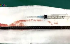 Cứu sống bệnh nhân bị thanh sắt xuyên từ đùi lên bụng