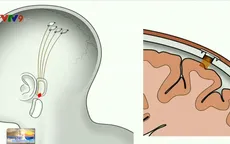 Tạo ra con chip gắn trong não người để kết nối với máy tính
