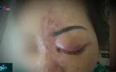 Hệ lụy khôn lường từ thẩm mỹ “chui”