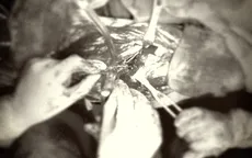 Giữ đôi chân cho nam sinh bị tai nạn giao thông trên đường đi thi đại học