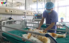 (Cập nhật) Tình hình cấp cứu 3 trẻ bị bỏng cồn trong giờ học ở Hà Nam