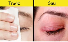 8 sai lầm khiến sản phẩm làm đẹp phản tác dụng