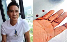 Hậu bị ám sát hụt, Nhậm Đạt Hoa vẫn phải đến bệnh viện mỗi ngày