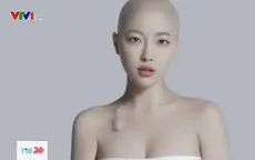 Nhật ký chiến đấu với ung thư của cô gái trẻ lay động triệu trái tim