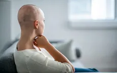 Sắp có thuốc giúp bệnh nhân ung thư không bị rụng tóc khi hóa trị