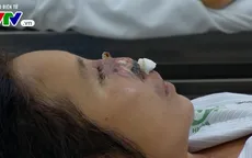 Bệnh Whitmore có lây từ người sang người hay không?
