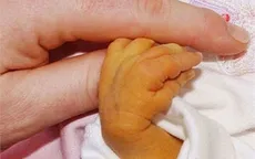 Trẻ 7 ngày tuổi phải thay máu vì sự chủ quan của cha mẹ