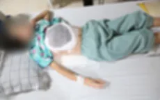 Tin lời thầy lang chữa ung thư vú, người phụ nữ nguy kịch