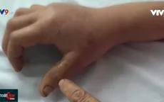 Đề phòng bị rắn tấn công trong mùa mưa