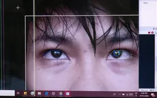 Hệ thống điều khiển bằng mắt hỗ trợ bệnh nhân giao tiếp