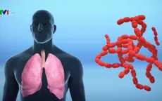 Bệnh viêm phổi do chủng virus mới diễn biến phức tạp