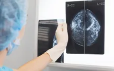 Trí tuệ nhân tạo có khả năng phát hiện ung thư vú