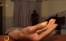 Chi giả như thật cho người khuyết tật