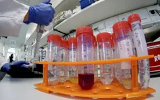 Du khách đến Singapore phải xét nghiệm PCR trong vòng 72 giờ trước khi khởi hành
