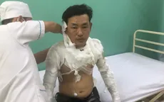 Thanh niên tẩm xăng cướp ngân hàng, tự thiêu khi bị truy bắt ở TP.HCM
