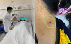 Nhiễm trùng, suy chức năng gan do bị sốt mò