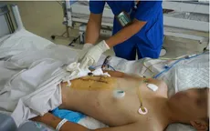 Cứu nam bệnh nhân sốc mất máu, vỡ gan phức tạp do tai nạn giao thông