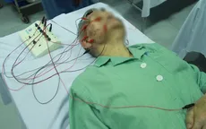 Cảnh báo bệnh liệt mặt, méo miệng khi trời trở lạnh