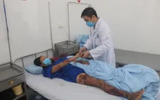 Cấp cứu điều trị bệnh nhân bị bỏng nước sôi 23% diện tích cơ thể
