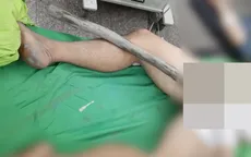 Cấp cứu thành công nạn nhân bị cọc gỗ 1,5m đâm xuyên tầng sinh môn