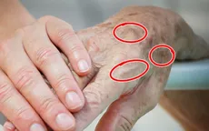 7 bộ phận lão hóa sớm nhất trên cơ thể