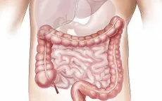 Rối loạn hoóc môn ruột điều hòa chất béo ở những người bị gan nhiễm mỡ