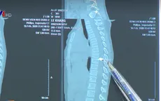 Bé trai bị liệt cả hai chân do đạn súng hơi đồ chơi
