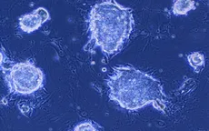 Thử nghiệm tế bào gốc iPS để chữa bệnh Parkinson