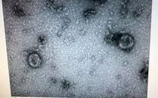 Việt Nam nuôi cấy và phân lập thành công virus Corona mới