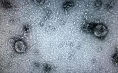 Việt Nam nuôi cấy và phân lập thành công virus corona