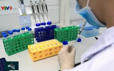 Huy động 10 tỷ đồng để sản xuất 20.000 bộ xét nghiệm COVID-19
