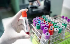 Nga phát triển 3 loại thuốc hỗ trợ điều trị COVID-19