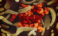 Nga đưa vào sử dụng bộ xét nghiệm nhiều chủng virus khác nhau