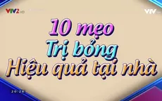 10 mẹo chữa bỏng tại nhà hiệu quả