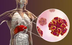 Tự ý dừng uống thuốc kháng virus viêm gan B - hậu quả khó lường