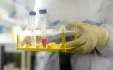 Mùa hè 2020, Viện Pasteur (Pháp) sẽ thử nghiệm vaccine phòng COVID-19 ở người