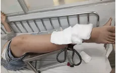 Trẻ bị đứt gân chân, gãy xương, bỏng nặng... - Hãy cẩn trọng bảo vệ trẻ trong mùa dịch!