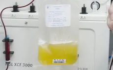 Ấn Độ: Bệnh nhân COVID-19 được chữa bằng huyết tương đã hồi phục