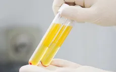 Tràn lan tình trạng buôn bán huyết tương bệnh nhân COVID-19 ở Iraq