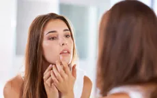 Tiết lộ phương pháp trị mụn viêm nấm bằng dầu gội