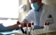 Italy thử nghiệm thành công kháng thể chống virus SARS-CoV-2