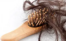 Tự ý mua thuốc xịt tóc, cô gái trẻ rụng gần hết tóc