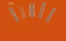 Australia đột phá trong sản xuất stent nhờ công nghệ in 3D