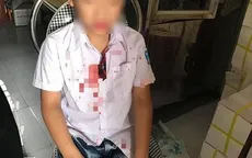 Khởi tố phụ huynh đánh bạn của con trước cổng trường học