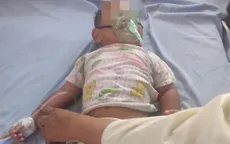Uống dầu hỏa đựng trong chai nước giải khát, bé 16 tháng nhập viện