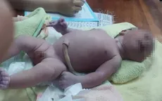 Hà Nội: Bé trai còn nguyên dây rốn bị bỏ trong túi màu hồng ở ven đường