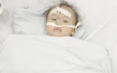 Bé 1 tuổi nguy kịch vì hóc... chôm chôm