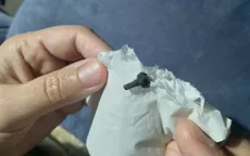 "Hắt xì" ra mảnh đồ chơi Lego mắc kẹt 2 năm trong mũi