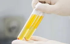 Bắt đầu sử dụng huyết tương điều trị bệnh nhân COVID-19