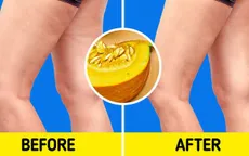 7 thực phẩm quen thuộc giúp bạn tạm biệt nỗi lo rạn da, trùng da